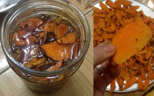Ngày nào cũng đều đặn uống nghệ và mật ong, nhưng bệnh trào ngược dạ dày của chú Thành vẫn tái phát