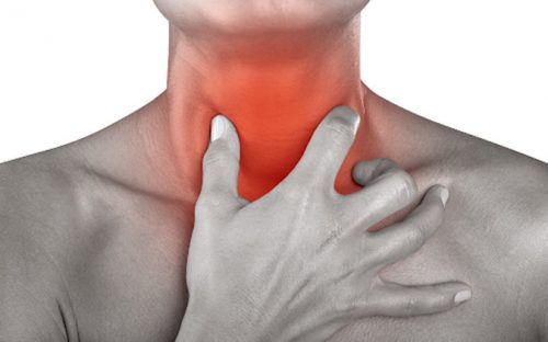 Biểu hiện trào ngược axit dạ dày gây viêm họng