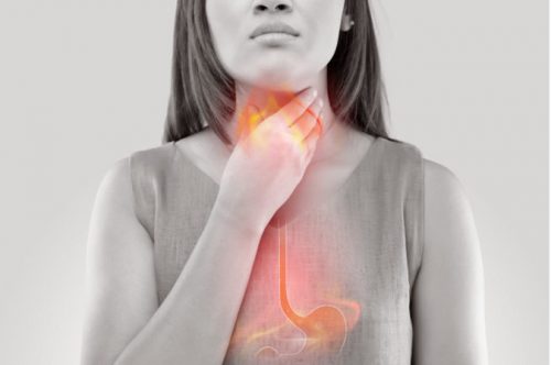 Trào ngược dạ dày nguyên nhân gây đầy bụng ợ hơi