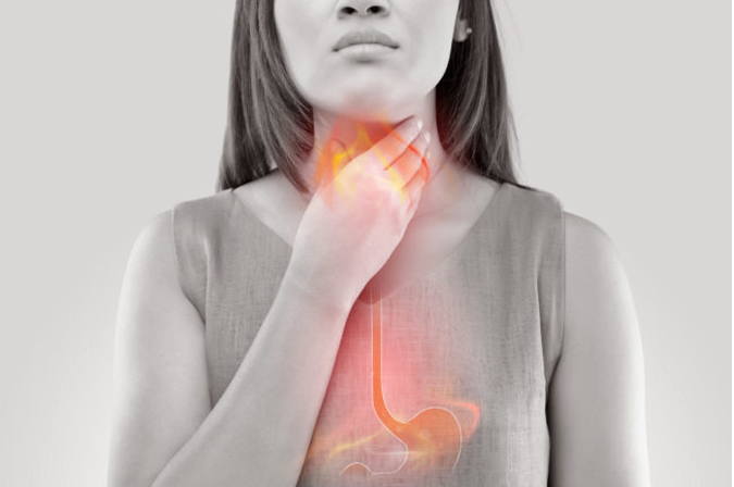Trào ngược dạ dày nguyên nhân gây đầy bụng ợ hơi