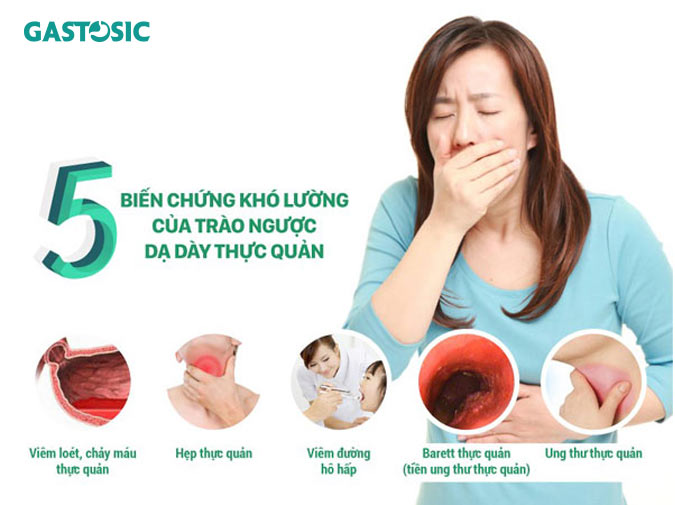 5 triệu chứng khó lường của trào ngược dạ dày thực quản