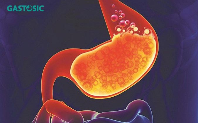 Ợ nóng xuất hiện sau những cơn trào ngược dạ dày
