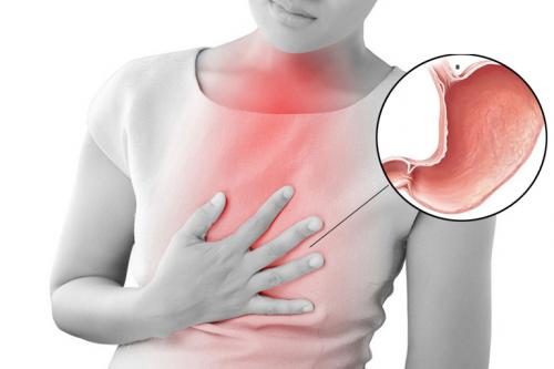 phân biệt trào ngược dạ dày