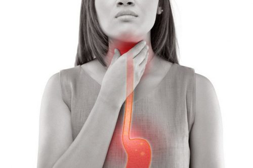 Trào ngược dạ dày lâu ngày gây ảnh hưởng đến vòm họng