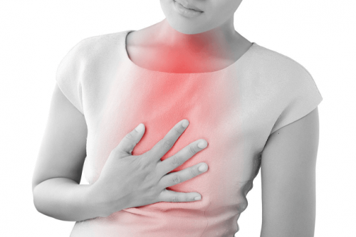 Đau ngực do trào ngược dạ dày thực quản được định nghĩa là các cơn đau có khả năng lan ra lưng, cổ, hàm hoặc cánh tay