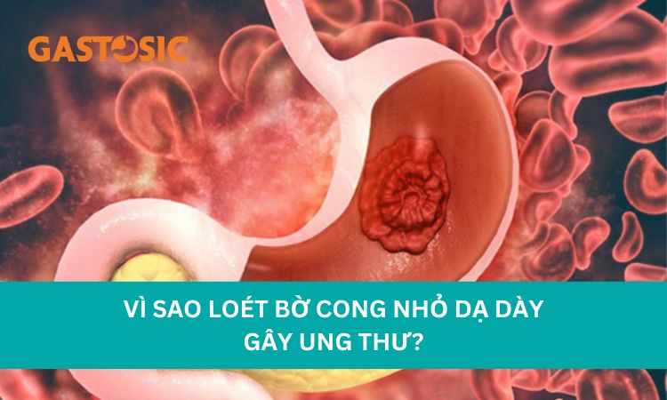 loet-bo-cong-nho-gay-ung-thu