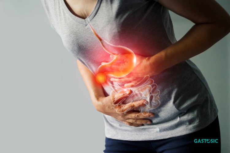Đau bụng là một trong những triệu chứng của viêm loét hành tá tràng